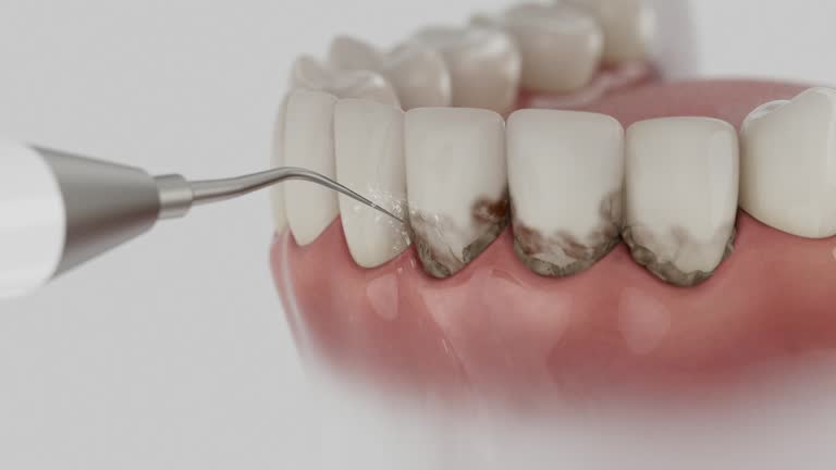 Reliable Dental contractor in Perezville, TX by Smile Center Dentistry